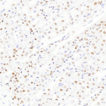 FOXP4 Recombinant Rabbit mAb (S-6198)