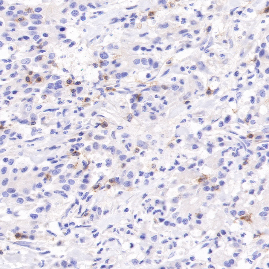 CD103 Recombinant Rabbit mAb (SDT-R134)
