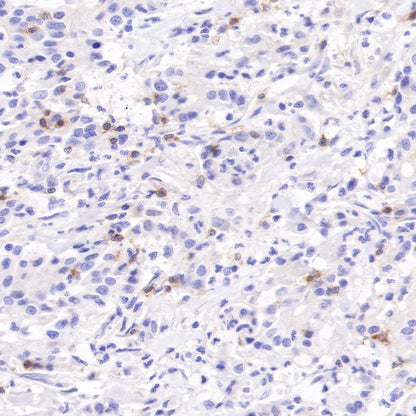 CD103 Recombinant Rabbit mAb (SDT-R134)