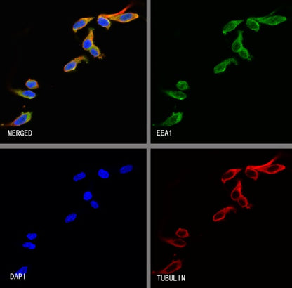 EEA1 Recombinant Rabbit mAb (S-2604-39)