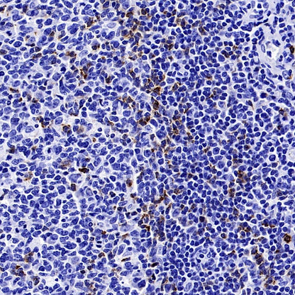 CTLA4 Recombinant Rabbit mAb (SDT-3348)