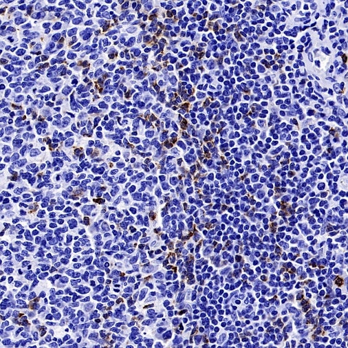 CTLA4 Recombinant Rabbit mAb (SDT-3348)