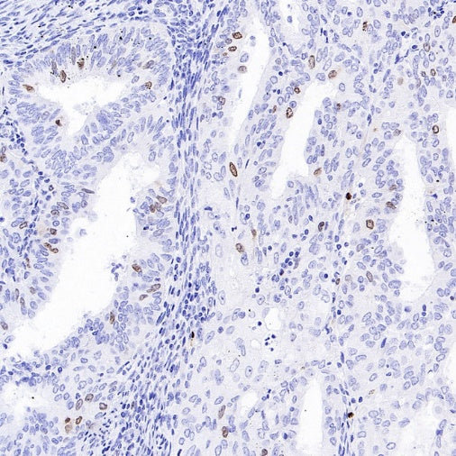 TOP2A Recombinant Rabbit mAb (S-513-107)