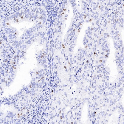 TOP2A Recombinant Rabbit mAb (S-513-107)
