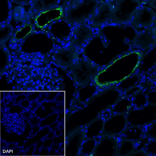 AQP2 Recombinant Rabbit mAb (SDT-2149-19)