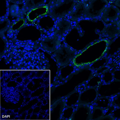 AQP2 Recombinant Rabbit mAb (SDT-2149-19)