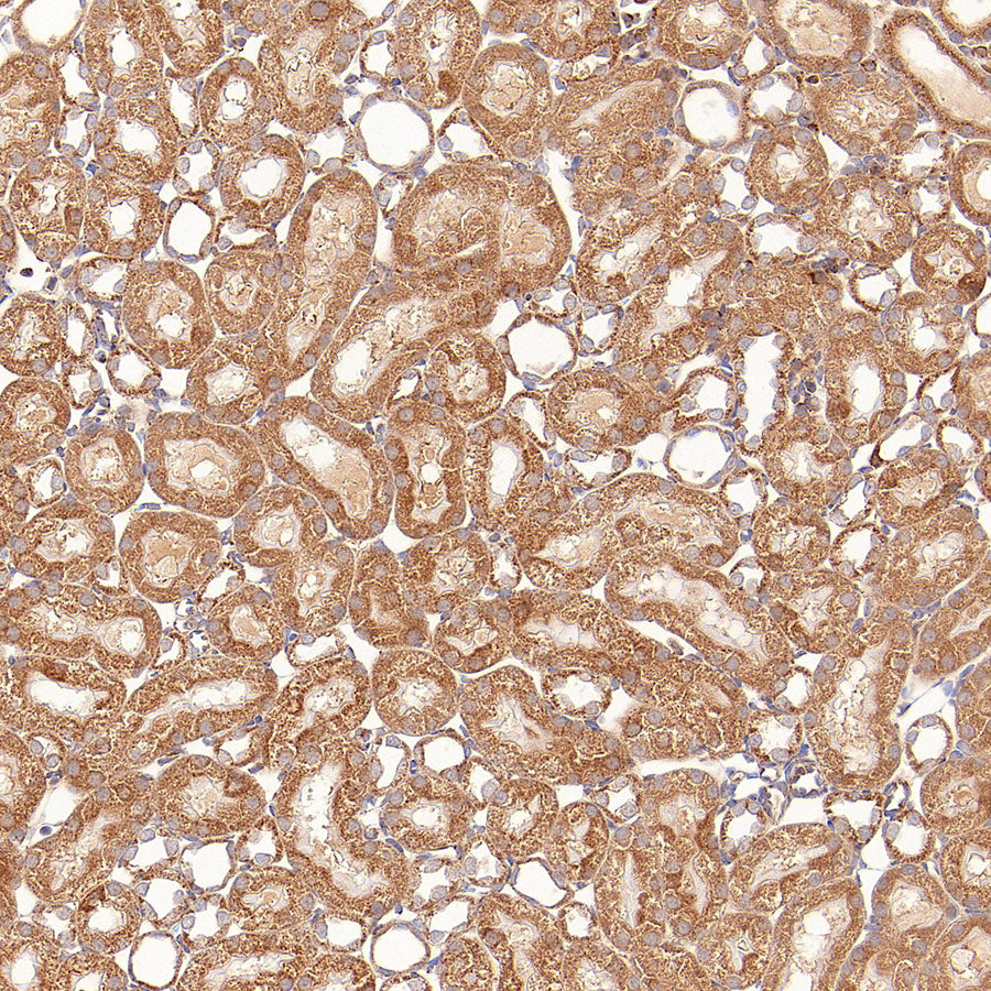 GOT2 Recombinant Rabbit mAb