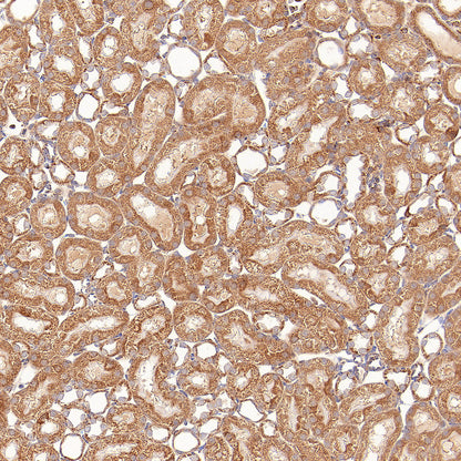 GOT2 Recombinant Rabbit mAb