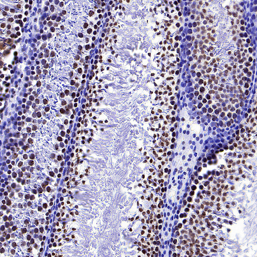 NPM1 Recombinant Rabbit mAb (S-4119-58)