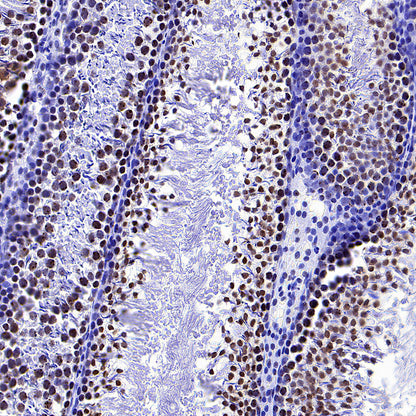 NPM1 Recombinant Rabbit mAb (S-4119-58)