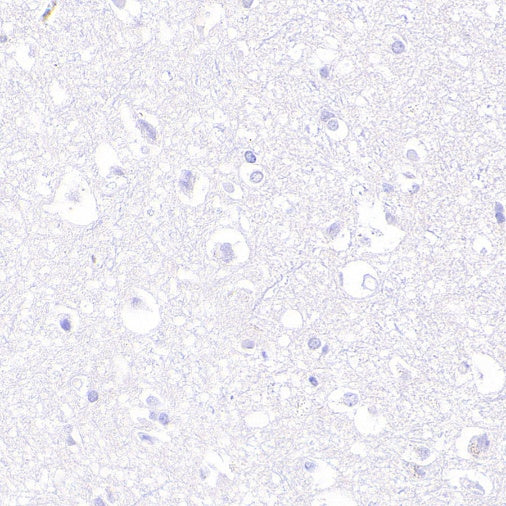 EBV Induced Gene 2/EBI2 Recombinant Rabbit mAb (S-5946)