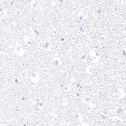 EBV Induced Gene 2/EBI2 Recombinant Rabbit mAb (S-5946)