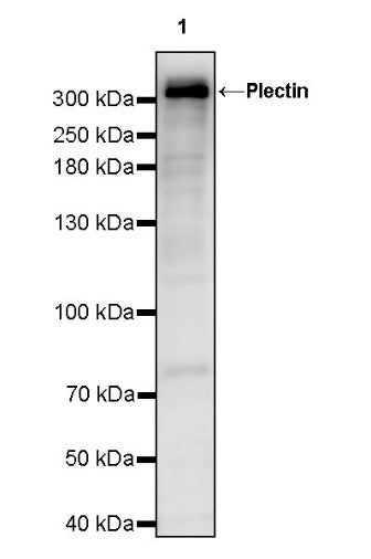 Plectin Recombinant Rabbit mAb (S-721-326)