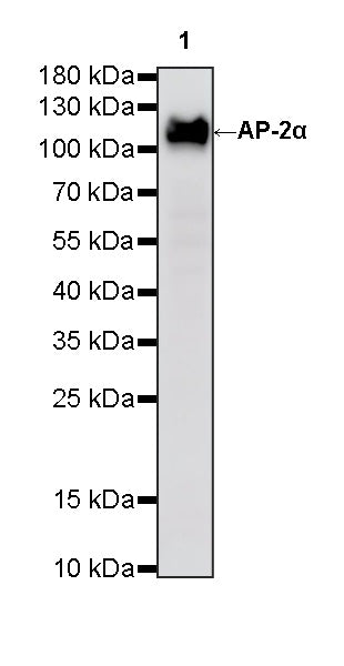 AP-2α Recombinant Rabbit mAb (S-4444-44)