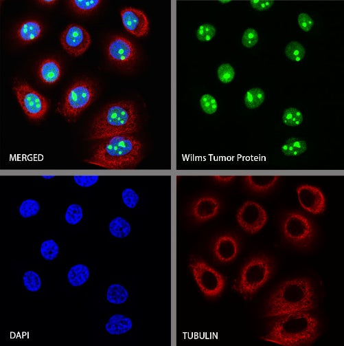 Wilms Tumor Protein (WT1) Recombinant Rabbit mAb (SDT-2864)