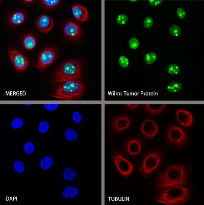 Wilms Tumor Protein (WT1) Recombinant Rabbit mAb (SDT-2864)