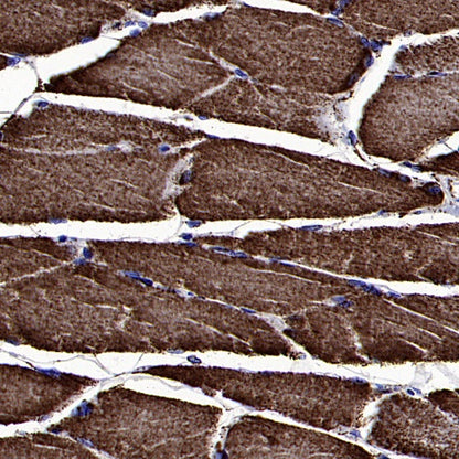 SOD2/MnSOD Rabbit Polyclonal Antibody