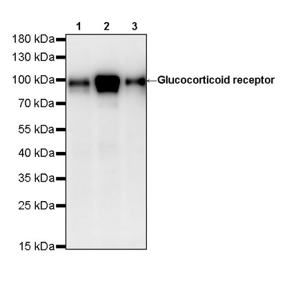 Glucocorticoid receptor Mouse mAb