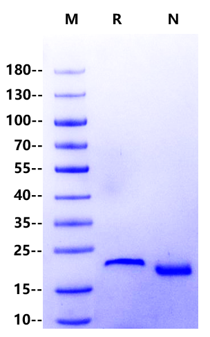 KRAS(G12D) His Tag Protein, Human