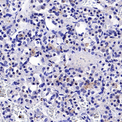 Claudin 9 Recombinant Rabbit mAb (S-2849-16)