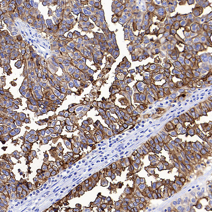 FOLR1 Recombinant Rabbit mAb (SDT-3635-124)