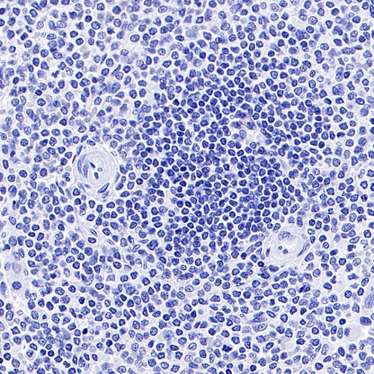 CD44v6 Recombinant Rabbit mAb (S-944-13)