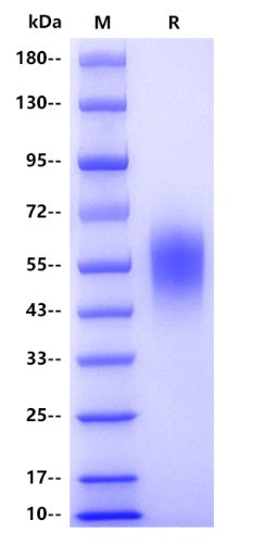 Mouse Soluble IL2R alpha/CD25 Protein, His Tag