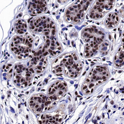 Estrogen Receptor β Recombinant Rabbit mAb (S-1396-67）