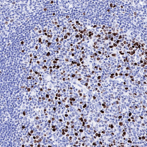Propionyl-Histone H4 (Lys5) Recombinant Rabbit mAb (S-R093)