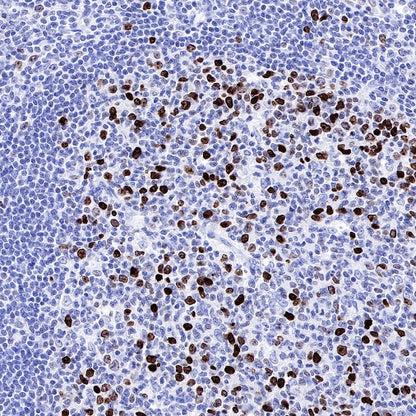 Propionyl-Histone H4 (Lys5) Recombinant Rabbit mAb (S-R093)