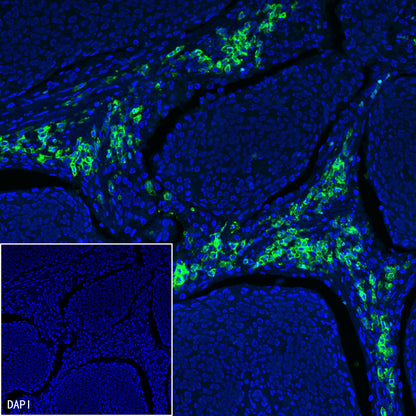 CD38 Mouse mAb (S-690-29)