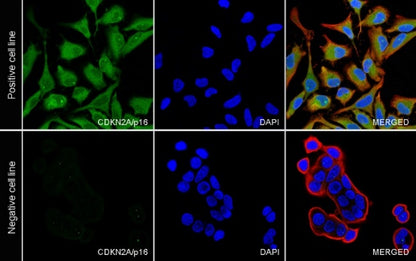 CDKN2A/p16 INK4A Recombinant Mouse mAb (SDT-4675)