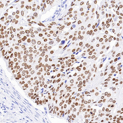 p40 Recombinant Rabbit mAb (SDT-166-116)