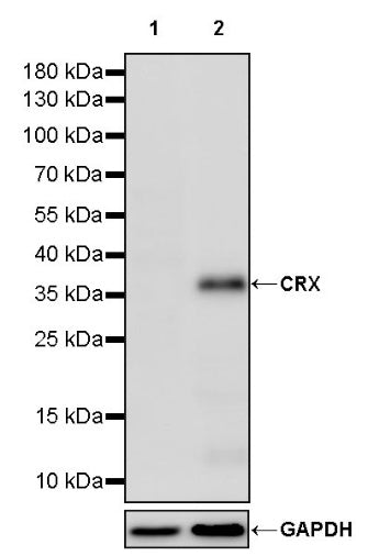 CRX Recombinant Rabbit mAb (SDT-2194-105)