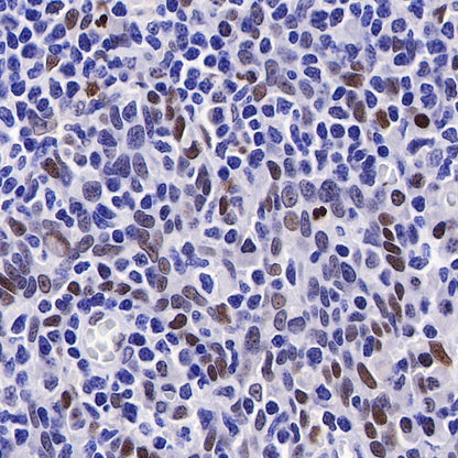PMS2 Recombinant Rabbit mAb (SDT-111-307)