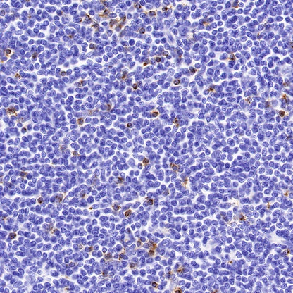 CD2 Recombinant Rabbit mAb (SDT-R261)