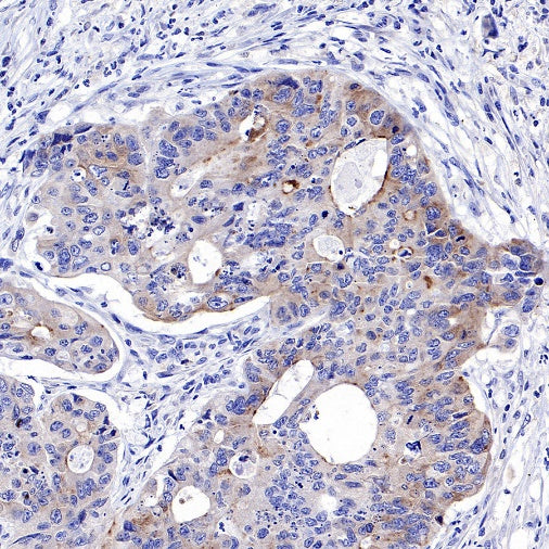 IGFBP2 Recombinant Rabbit mAb (S-808-24)