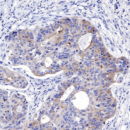 IGFBP2 Recombinant Rabbit mAb (S-808-24)
