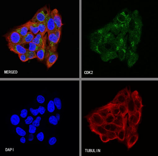 CDK2 Recombinant Rabbit mAb (S-1308-13)