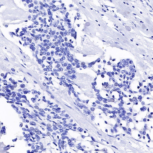 TPO Recombinant Rabbit mAb (SDT-420-57-1)