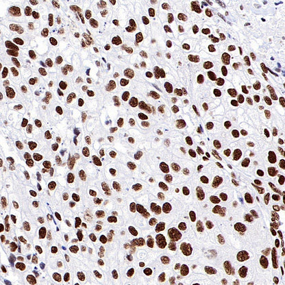 ARID1A Recombinant Rabbit mAb (S-440-27)
