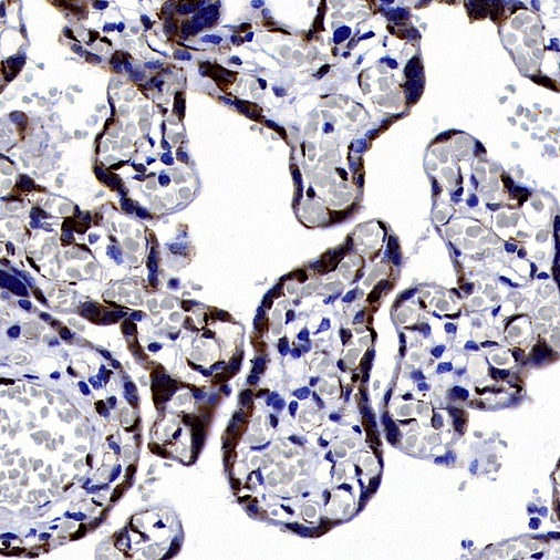LIN28B Recombinant Rabbit mAb (S-2360-117)