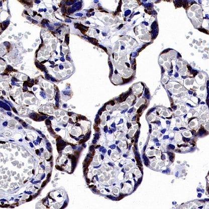 LIN28B Recombinant Rabbit mAb (S-2360-117)