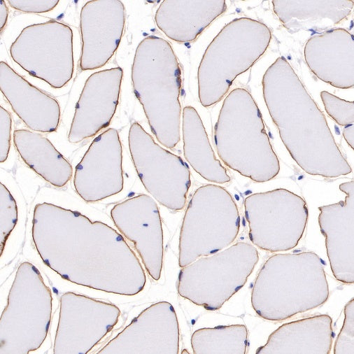 Dystrophin Recombinant Rabbit mAb (S-090-327)