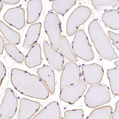 Dystrophin Recombinant Rabbit mAb (S-090-327)