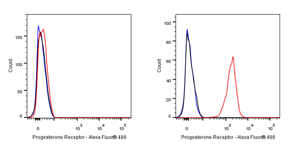 Progesterone Receptor Recombinant Rabbit mAb (SDT-R123)