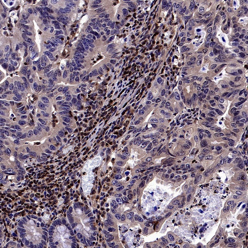 Stat5b Recombinant Rabbit mAb (S-2951-34)