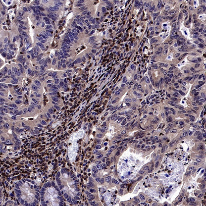 Stat5b Recombinant Rabbit mAb (S-2951-34)