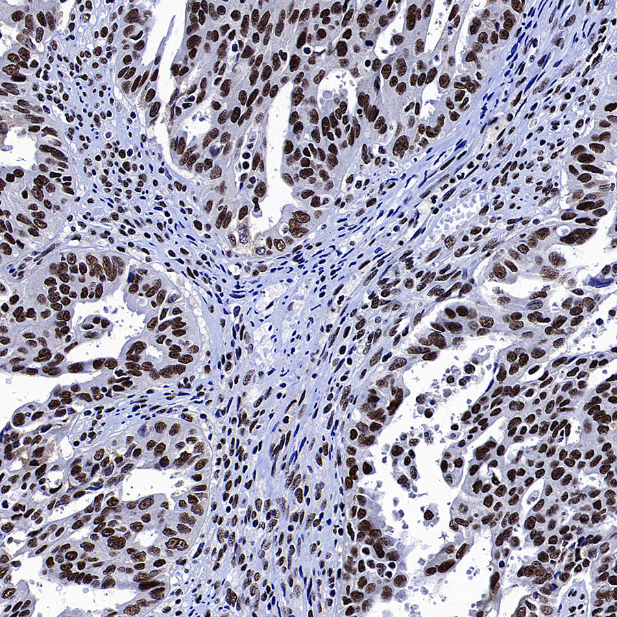 p300 Recombinant Rabbit mAb (S-2612-122)