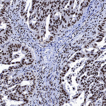 p300 Recombinant Rabbit mAb (S-2612-122)